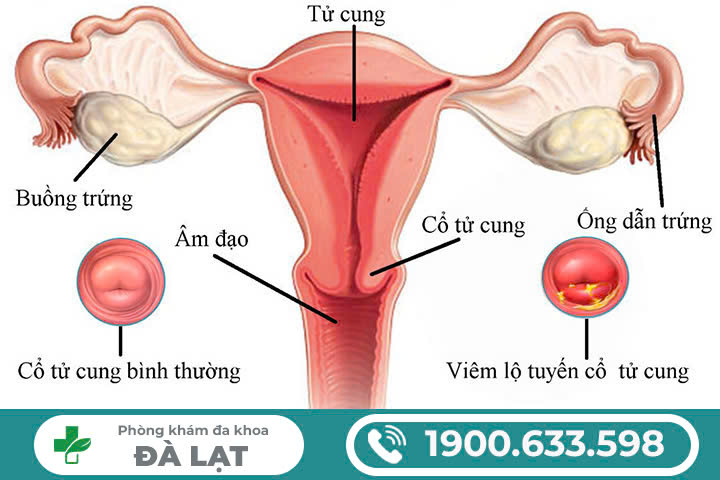 Hình ảnh minh họa